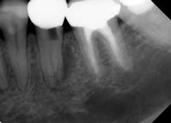 Mouncepreopfig1 Mouncepreopfig1