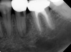 Mouncepreopfig1 Mouncepreopfig1