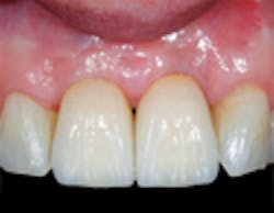 BioHorizons-2 BioHorizons-2