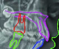 carestream-software carestream-software