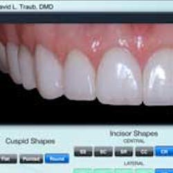 smile-guide-2 smile-guide-2