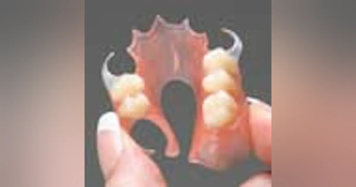Duraflex Rpd Duraflex Partial Denture is lightweight, flexible | Dentistry IQ