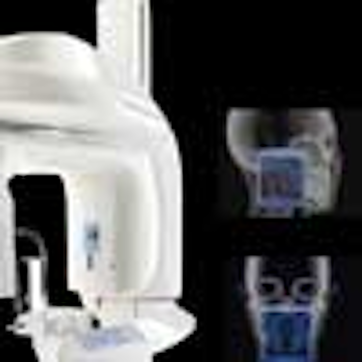 carestream-CS9300-2