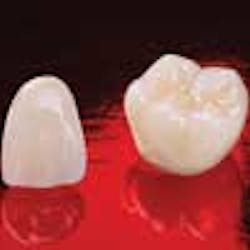 Content Dam Diq Online Articles 2013 01 Glidewell Obsidian100 Content Dam Diq Online Articles 2013 01 Glidewell Obsidian100