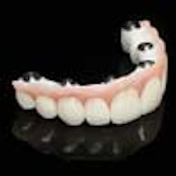 Content Dam Diq Online Articles 2013 02 Aurum Tek Bridges100 Content Dam Diq Online Articles 2013 02 Aurum Tek Bridges100