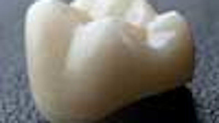 Content Dam Diq Online Articles 2013 03 Aurum Opalite Spectrum100