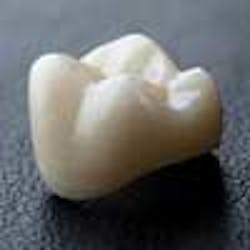 Content Dam Diq Online Articles 2013 03 Aurum Opalite Spectrum100 Content Dam Diq Online Articles 2013 03 Aurum Opalite Spectrum100