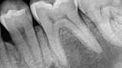 Content Dam Diq Online Articles 2015 02 15feb19bczuroff01 Article Thumbnail Content Dam Diq Online Articles 2015 02 15feb19bczuroff01 Article Thumbnail