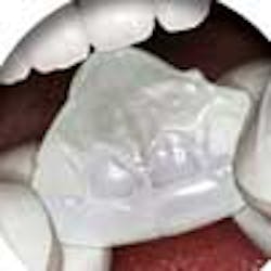 Content Dam Diq Online Articles 2013 06 Nitebite100 Content Dam Diq Online Articles 2013 06 Nitebite100