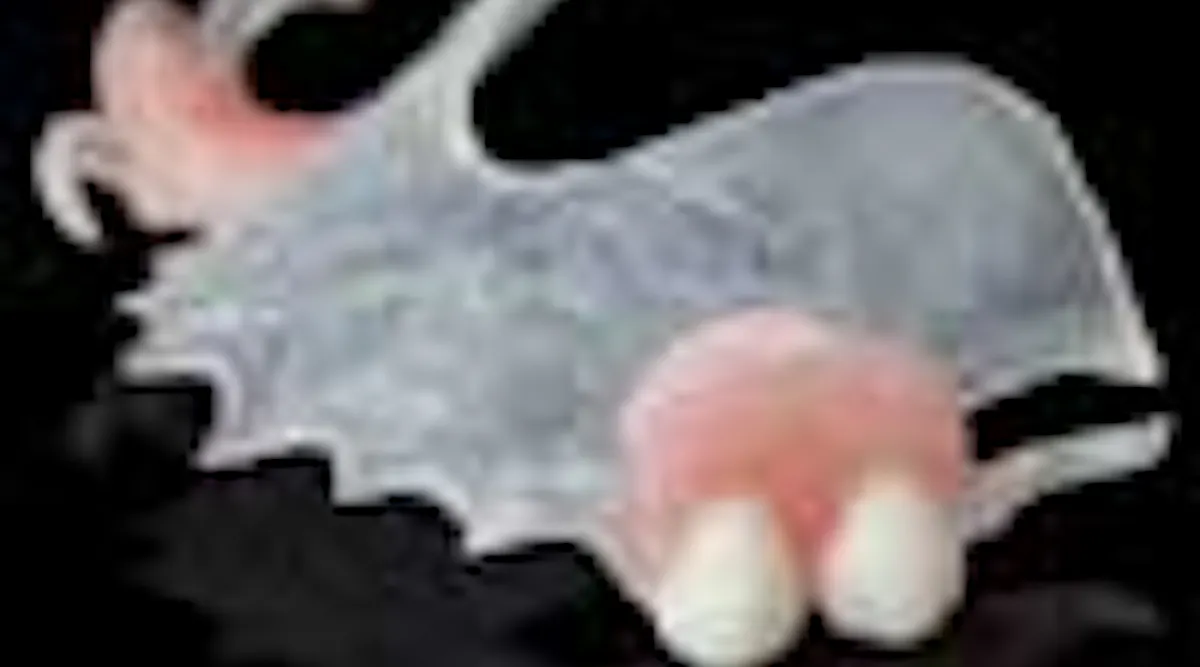 Visiclear Rpd MicroDental Labs introduces VisiClear Partial Dentures | Dentistry IQ