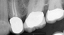 Content Dam Diq Online Articles 2014 12 14dec16endosimmons02 Success Failure Thumbnail Content Dam Diq Online Articles 2014 12 14dec16endosimmons02 Success Failure Thumbnail