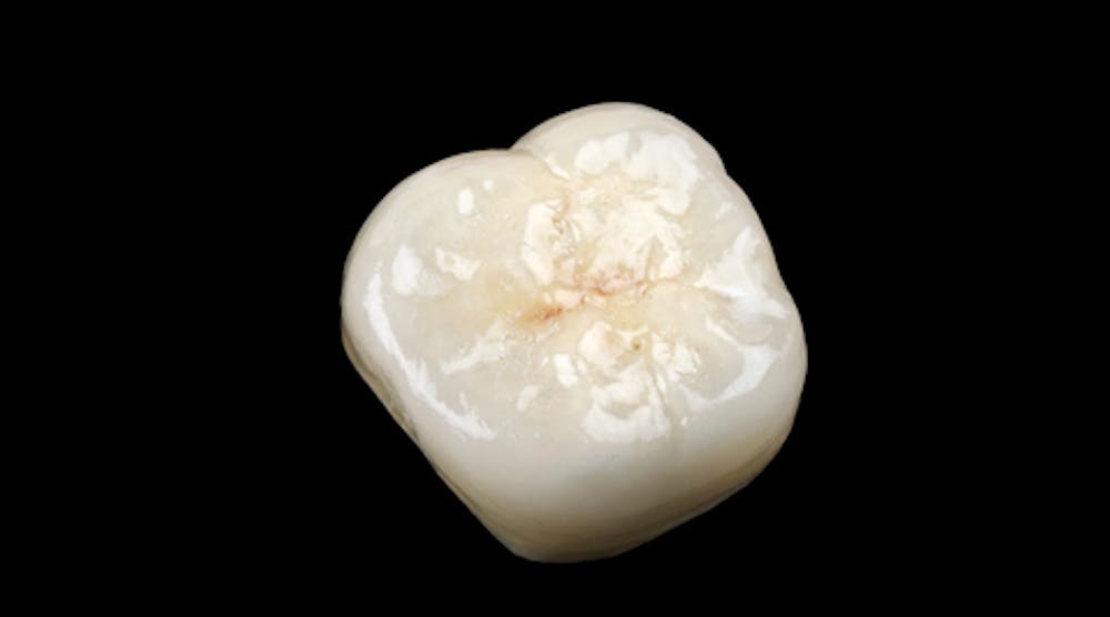 Join the digital workflow: The case for chairside CAD/CAM | Dentistry IQ