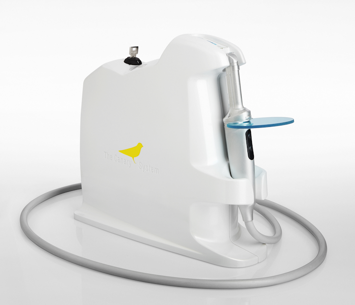 Content Dam Diq Online Articles 2015 02 Canary System