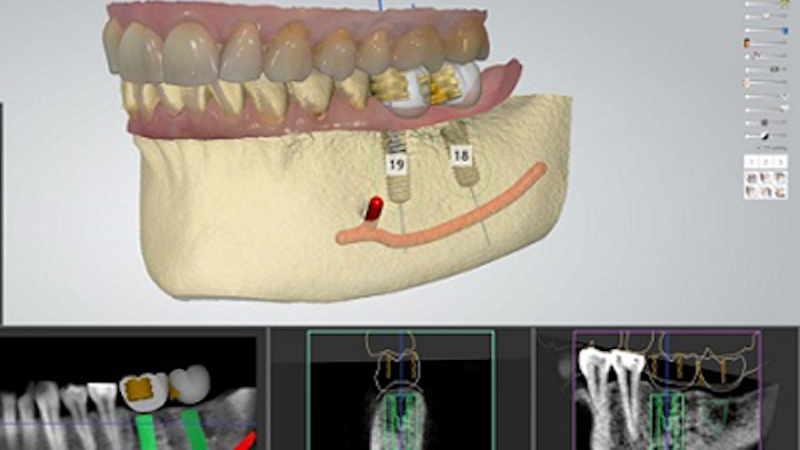 Content Dam Diq Online Articles 2015 02 Implant Softwarethumbnail