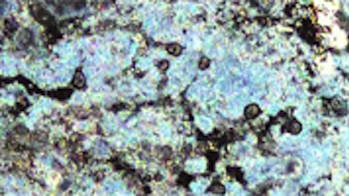 Periodontitis biofilm