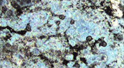 Periodontitis biofilm Periodontitis biofilm