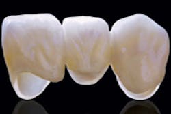 Content Dam Diq Online Articles 2015 03 Dental Lab Content Dam Diq Online Articles 2015 03 Dental Lab