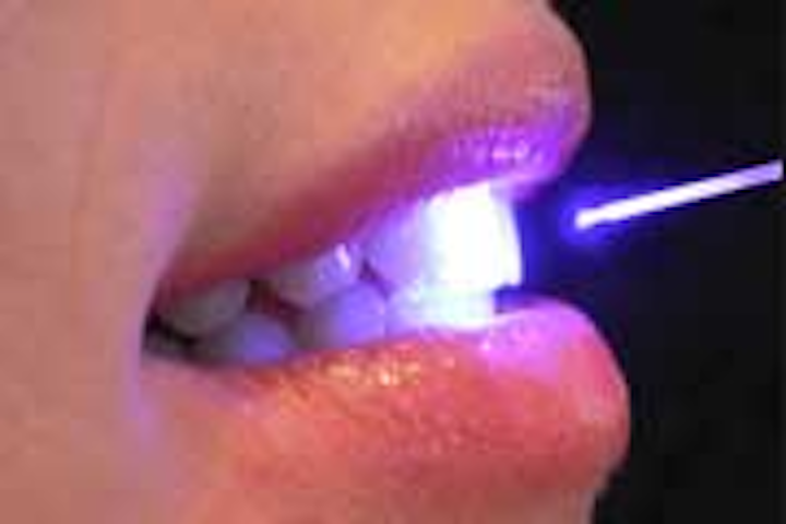 Content Dam Diq Online Articles 2015 03 Dental Laser 1