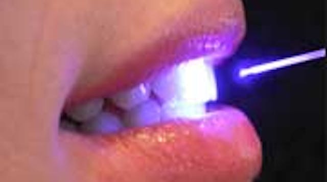 Content Dam Diq Online Articles 2015 03 Dental Laser 1