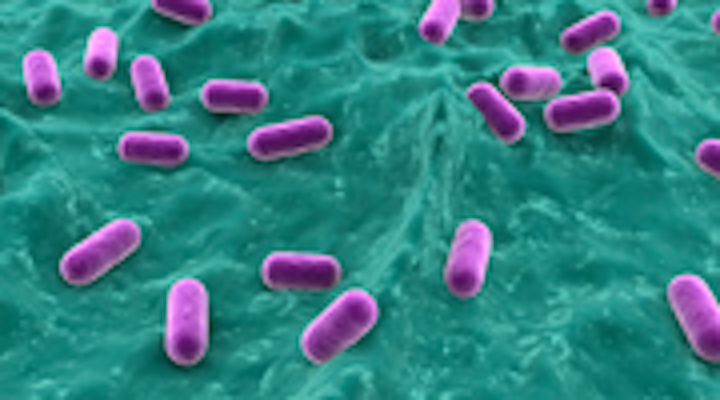 Content Dam Diq Online Articles 2015 03 Lactobacillus180 100