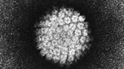 Content Dam Diq Online Articles 2015 03 Papilloma Virus Hpv Em 180 100 Content Dam Diq Online Articles 2015 03 Papilloma Virus Hpv Em 180 100