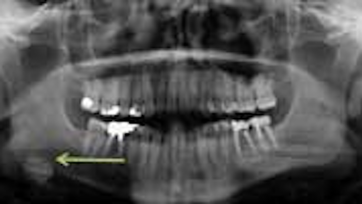 Content Dam Diq Online Articles 2015 04 15apr2bc Pathology Case03 Article Thumbnail