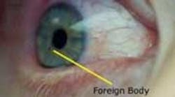 Content Dam Diq Online Articles 2015 04 Eye Safety Article Thumbnail Content Dam Diq Online Articles 2015 04 Eye Safety Article Thumbnail