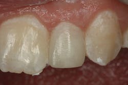 Content Dam Diq Online Articles 2015 04 Margeas Fig 03 Content Dam Diq Online Articles 2015 04 Margeas Fig 03