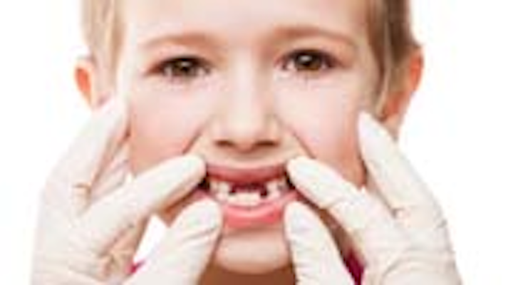 Content Dam Diq Online Articles 2015 04 Missing Teeth Thumbnail
