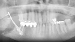 Content Dam Diq Online Articles 2015 04 Onj Thumbnail 2 Content Dam Diq Online Articles 2015 04 Onj Thumbnail 2