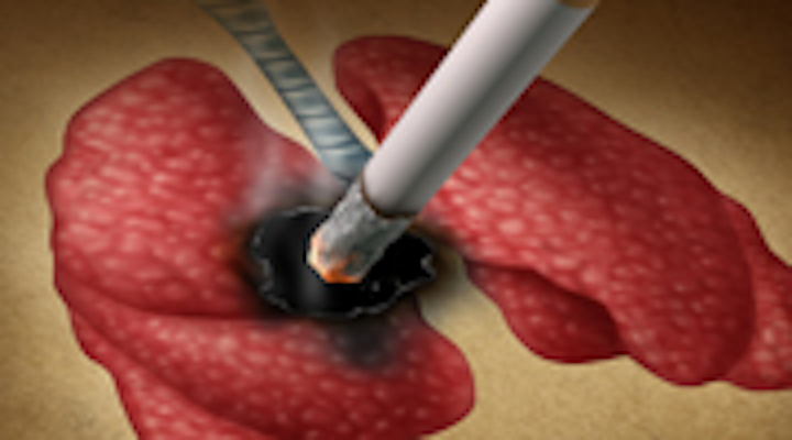 Content Dam Diq Online Articles 2015 04 Smoking Lung 180 100