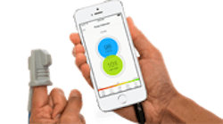 Content Dam Diq Online Articles 2015 04 The Phone Oximeter Phone And Sensor 180 100 Content Dam Diq Online Articles 2015 04 The Phone Oximeter Phone And Sensor 180 100