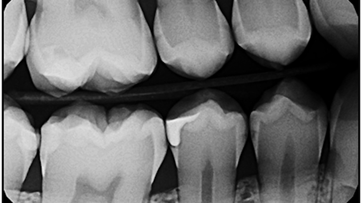 Content Dam Diq Online Articles 2015 04 X Ray Zollo
