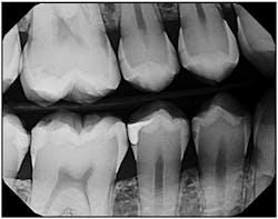 Content Dam Diq Online Articles 2015 04 X Ray Zollo Content Dam Diq Online Articles 2015 04 X Ray Zollo