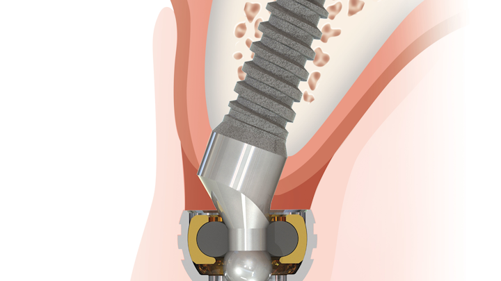 Content Dam Diq Online Articles 2015 04 Zest Saturno Angled Maxilla