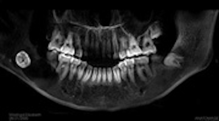 Content Dam Diq Online Articles 2015 05 15may7bc Pathology Case04 Article Thumbnail
