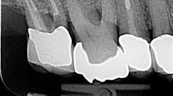 Content Dam Diq Online Articles 2015 05 15may7bcmusikant Endoefficiency02 360 200 Content Dam Diq Online Articles 2015 05 15may7bcmusikant Endoefficiency02 360 200