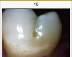 Content Dam Diq Online Articles 2015 05 Canary Figure 1 Content Dam Diq Online Articles 2015 05 Canary Figure 1