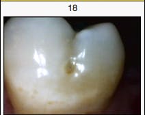 Content Dam Diq Online Articles 2015 05 Canary Figure 1 Content Dam Diq Online Articles 2015 05 Canary Figure 1