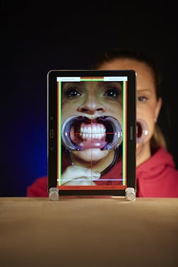 Content Dam Diq Online Articles 2015 05 Maxalign Pr Content Dam Diq Online Articles 2015 05 Maxalign Pr