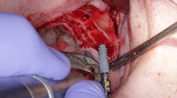 Content Dam Diq Online Articles 2015 06 15june4bc Simmons Minixtrememakeover Article Thumb Content Dam Diq Online Articles 2015 06 15june4bc Simmons Minixtrememakeover Article Thumb