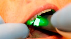 Content Dam Diq Online Articles 2015 06 Intraoral Camera 1 Content Dam Diq Online Articles 2015 06 Intraoral Camera 1