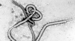 Content Dam Diq Online Articles 2015 07 Ebola Virus Em Web 360 200 Content Dam Diq Online Articles 2015 07 Ebola Virus Em Web 360 200
