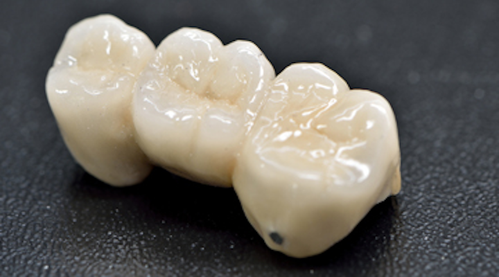 Content Dam Diq Print Articles Volume 2 Issue 4 Ceramic Crown 360 200