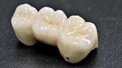 Content Dam Diq Print Articles Volume 2 Issue 4 Ceramic Crown 360 200 Content Dam Diq Print Articles Volume 2 Issue 4 Ceramic Crown 360 200