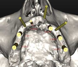 1208simosfig1 1208simosfig1