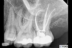 1309endobehrents2 1309endobehrents2