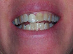 13decbfssegal01 13decbfssegal01