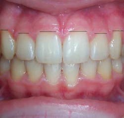 13decbfssegal02cropped 13decbfssegal02cropped