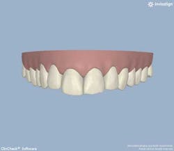 13decbfssegal03 13decbfssegal03